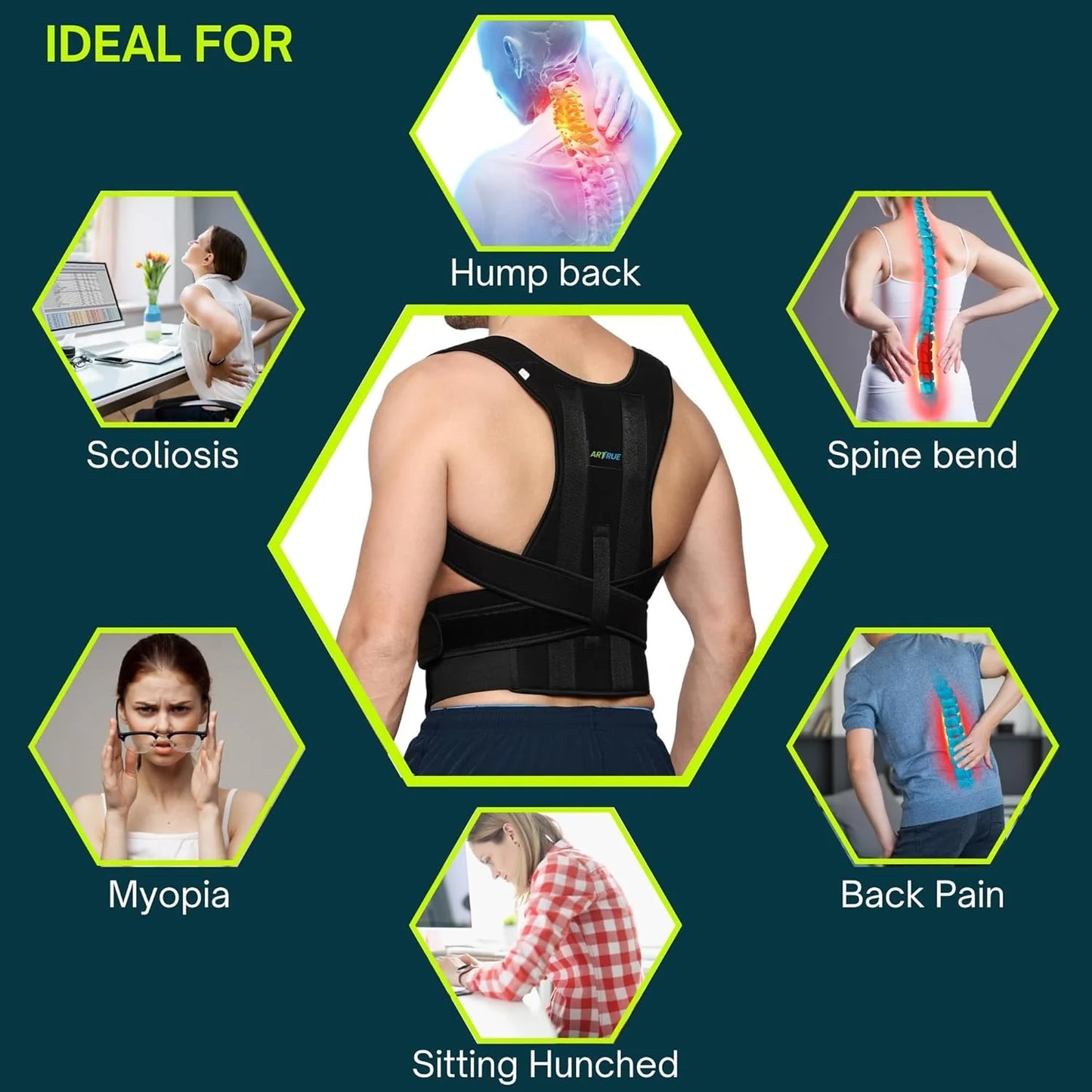 Wisecart™ Adjustable Posture Corrector – Back, Neck & Shoulder Support
